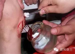 舌下放血疗法视频,揭秘古老养生秘术的现代应用