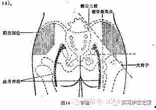肌注视频,视频教学助您轻松掌握